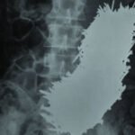 nails-in-stomach-ibtn9