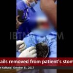 nails-in-stomach-video-ibtn9